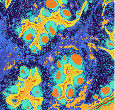 Spatial Transcriptomics
